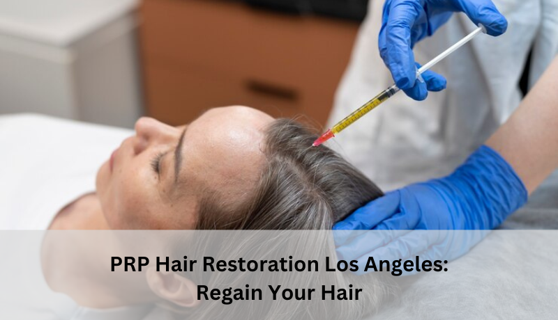 prp hair restoration Los Angeles