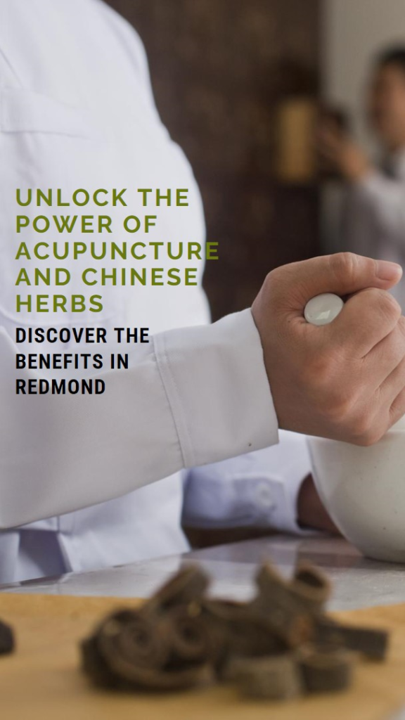 Redmond acupuncture