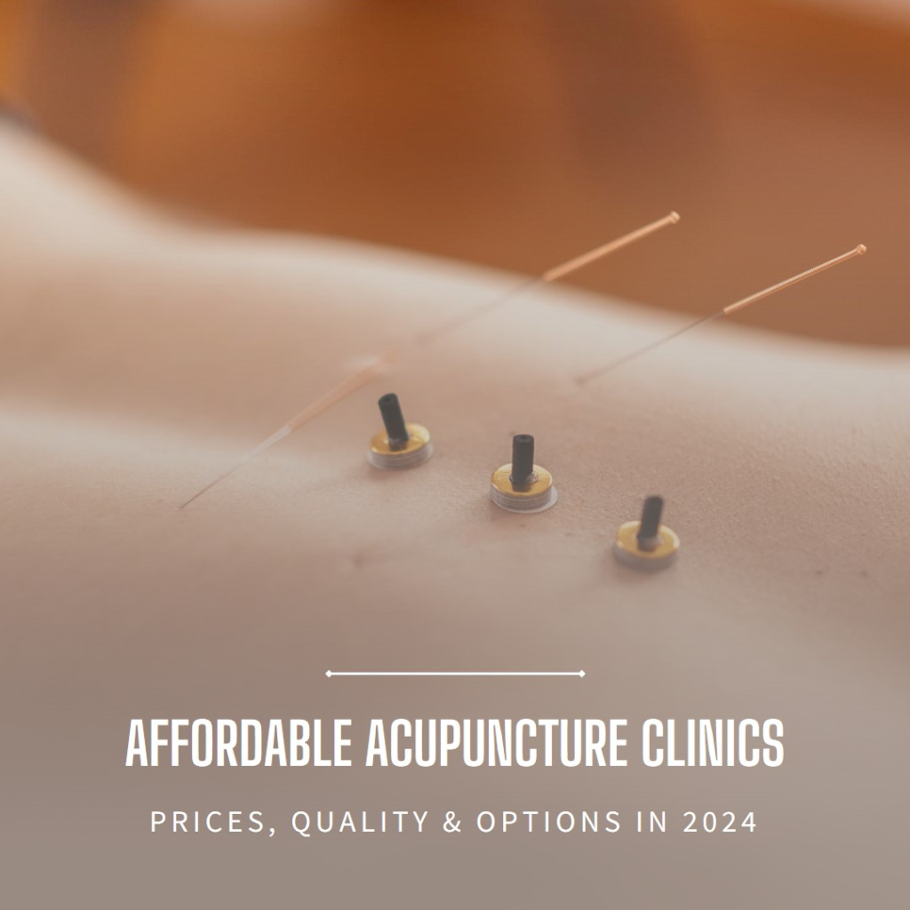 Acupuncture price